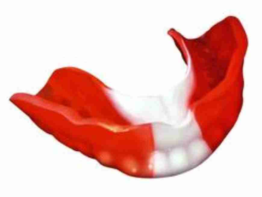 Read more about the article Juniors: Don’t forget a mouthguard !